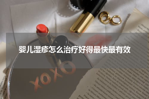 婴儿湿疹怎么治疗好得最快最有效