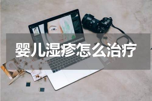 婴儿湿疹怎么治疗