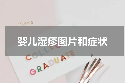 婴儿湿疹图片和症状