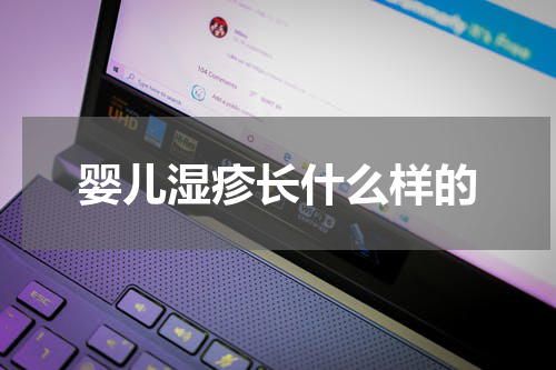 婴儿湿疹长什么样的