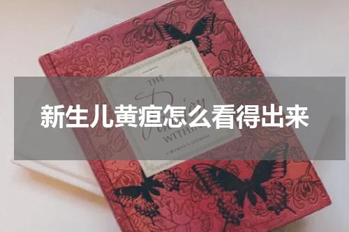 新生儿黄疸怎么看得出来