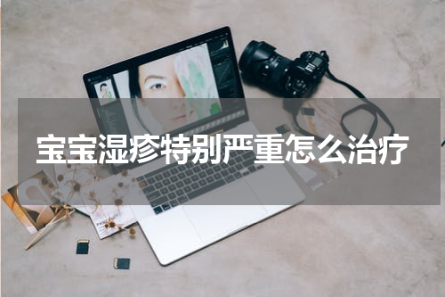 宝宝湿疹特别严重怎么治疗