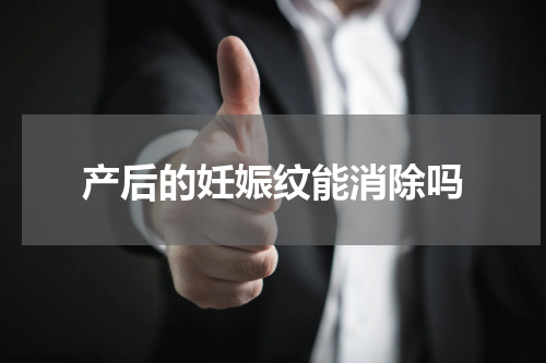 产后的妊娠纹能消除吗